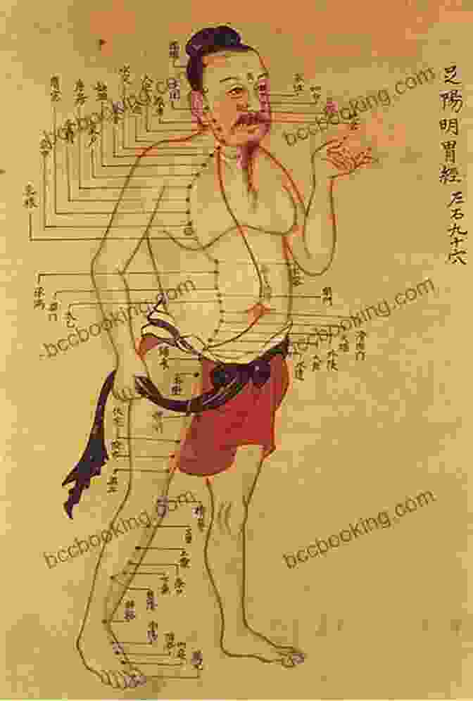 Ancient Chinese Drawing Of Pregnant Woman Receiving Acupuncture The Infertility Cure: The Ancient Chinese Wellness Program For Getting Pregnant And Having Healthy Babies